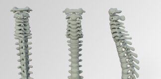 Jaki olej na wypadanie włosów?