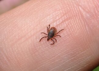 Co wymiata pasożyty z organizmu? Co wymiata pasożyty z organizmu?